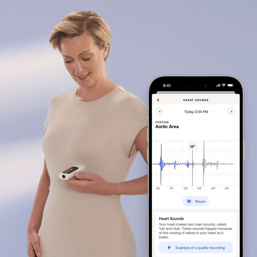 Zdravotní monitor Withings 4v1 BeamO – bílý - bonami.click